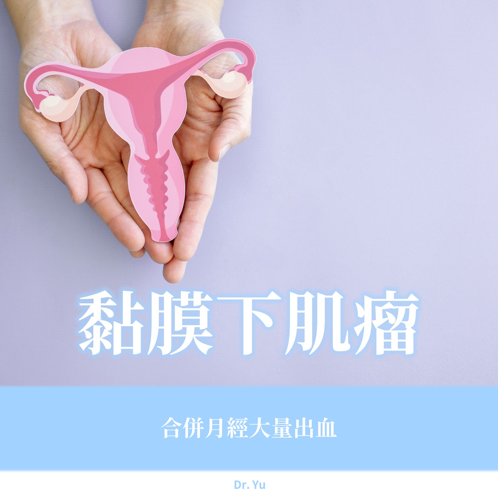 27歲的她,月經量一直很多,原來子宮裡藏著3顆肌瘤|游正暐醫師